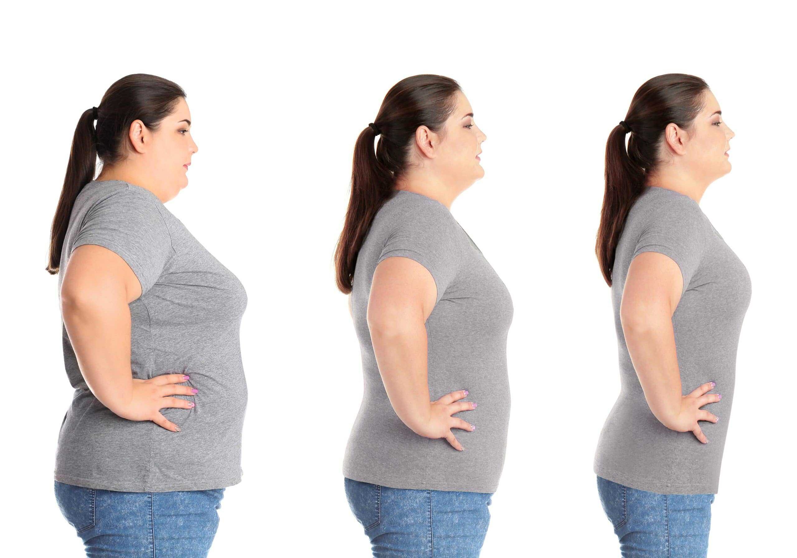 Woman before and after weight loss on white background, collage